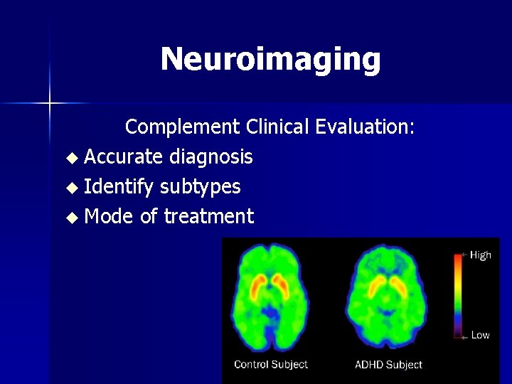 Neuroimaging Complement Clinical Evaluation: u Accurate diagnosis u Identify subtypes u Mode of treatment