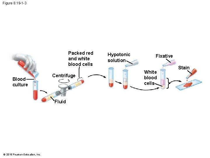 Figure 8. 19 -1 -3 Packed red and white blood cells Blood culture Centrifuge