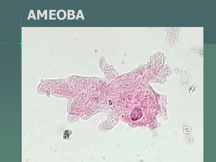 AMEOBA 