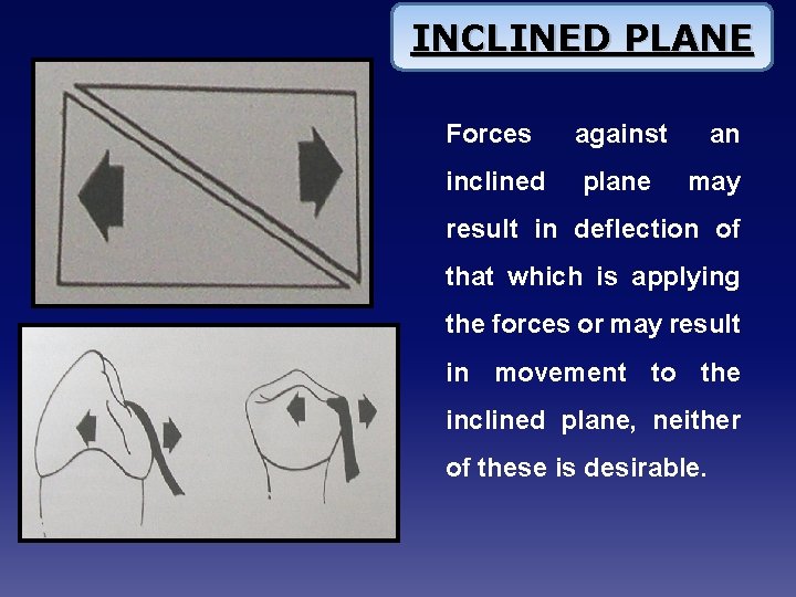 INCLINED PLANE Forces against inclined plane an may result in deflection of that which
