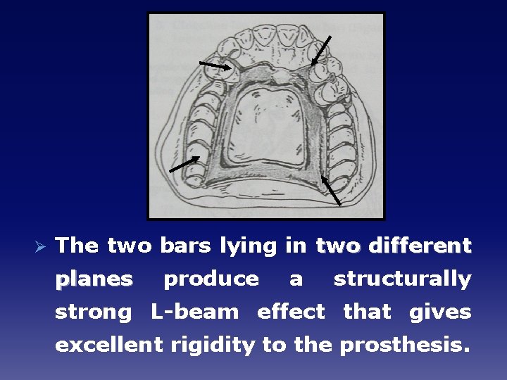 Ø The two bars lying in two different planes produce a structurally strong L-beam