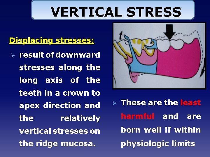 VERTICAL STRESS Displacing stresses: Ø result of downward stresses along the long axis of