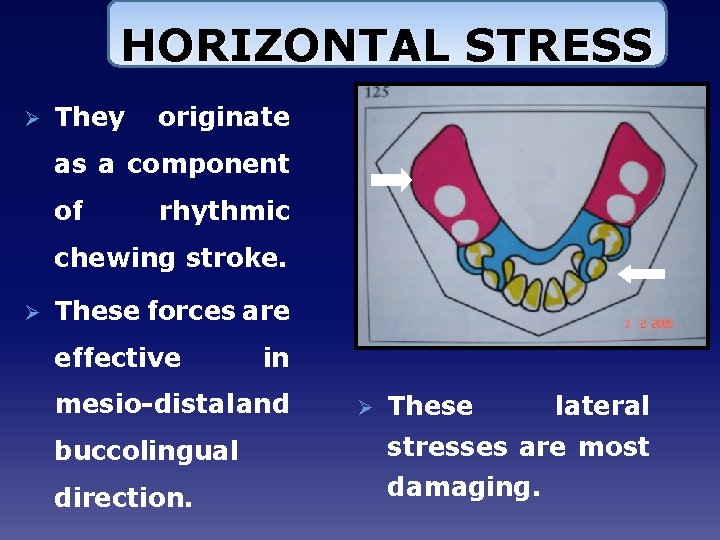 HORIZONTAL STRESS Ø They originate as a component of rhythmic chewing stroke. Ø These