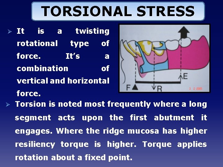 TORSIONAL STRESS Ø It is a twisting rotational force. type It’s combination of a