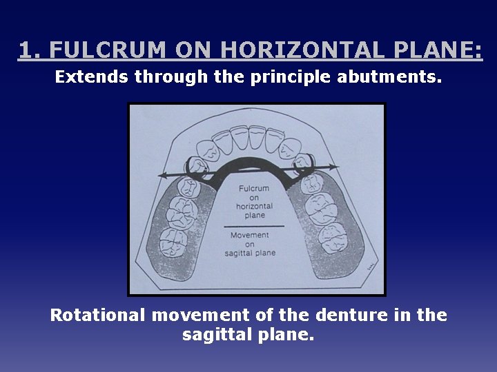 1. FULCRUM ON HORIZONTAL PLANE: Extends through the principle abutments. Rotational movement of the