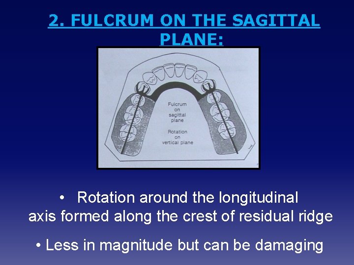 2. FULCRUM ON THE SAGITTAL PLANE: • Rotation around the longitudinal axis formed along