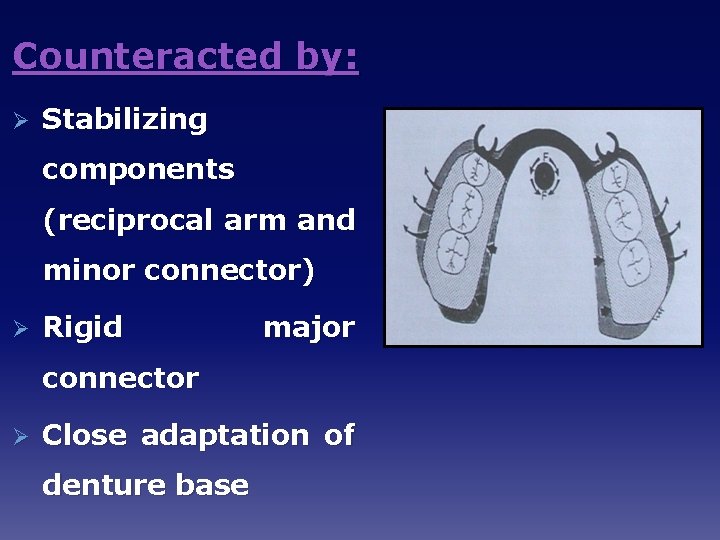 Counteracted by: Ø Stabilizing components (reciprocal arm and minor connector) Ø Rigid major connector