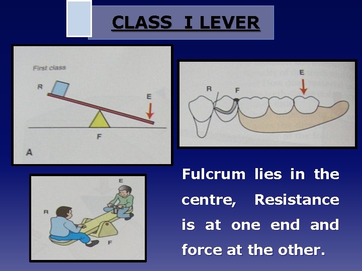 CLASS I LEVER Fulcrum lies in the centre, Resistance is at one end and