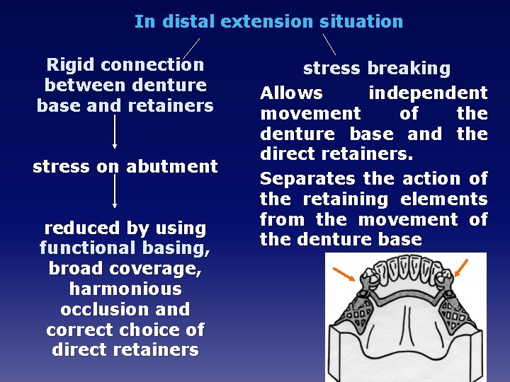 In distal extension situation Rigid connection between denture base and retainers stress on abutment