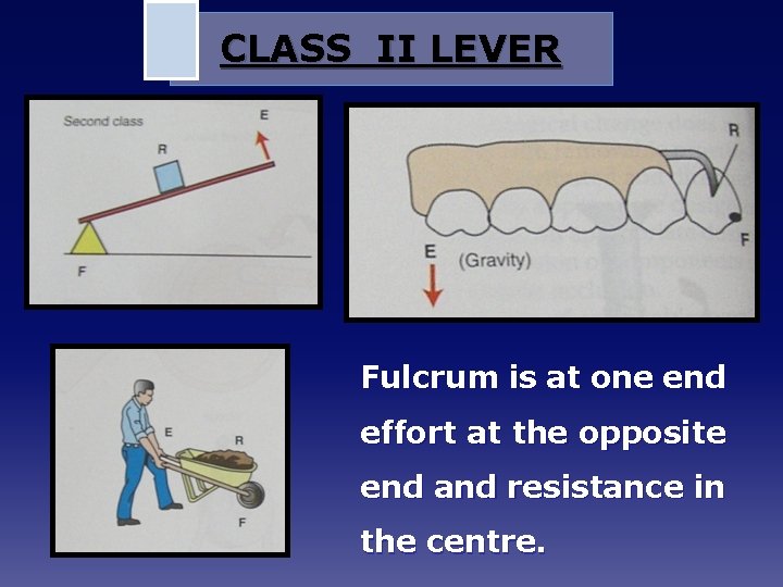 CLASS II LEVER Fulcrum is at one end effort at the opposite end and