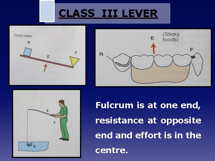 CLASS III LEVER Fulcrum is at one end, resistance at opposite end and effort