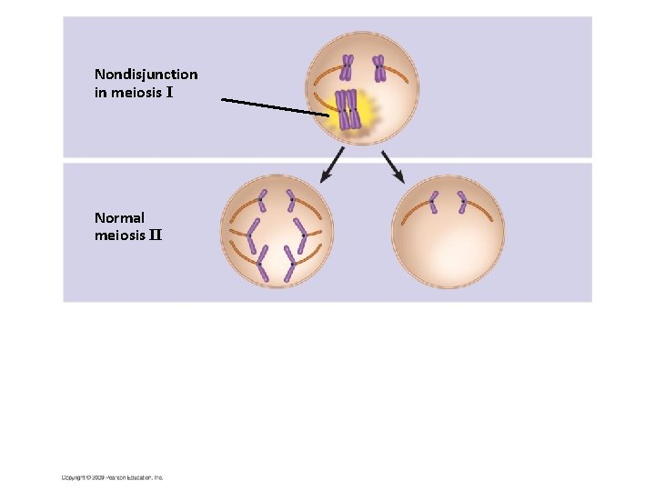Nondisjunction in meiosis I Normal meiosis II 