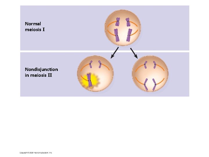 Normal meiosis I Nondisjunction in meiosis II 