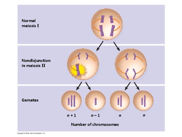 Normal meiosis I Nondisjunction in meiosis II Gametes n+1 n– 1 n Number of