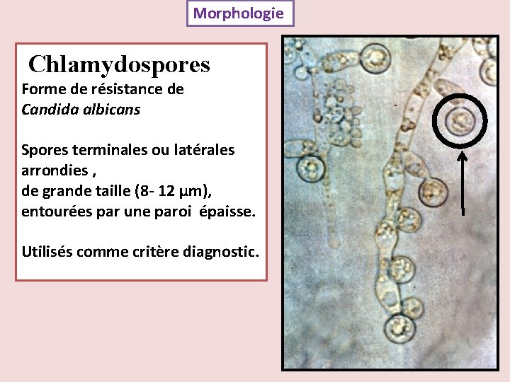 Morphologie Chlamydospores Forme de résistance de Candida albicans Spores terminales ou latérales arrondies ,