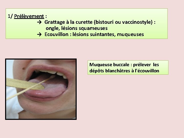 1/ Prélèvement : → Grattage à la curette (bistouri ou vaccinostyle) : ongle, lésions