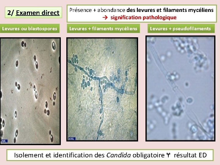2/ Examen direct Levures ou blastospores Présence + abondance des levures et filaments mycéliens