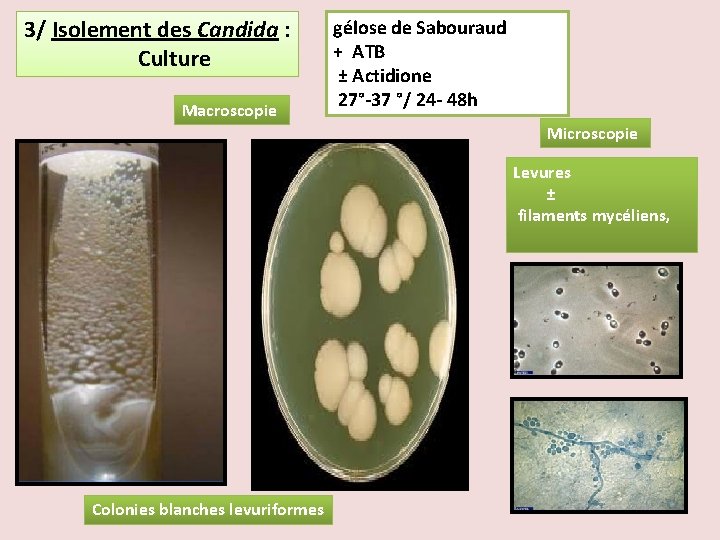 3/ Isolement des Candida : gélose de Sabouraud + ATB Culture Macroscopie ± Actidione