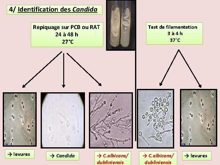 4/ Identification des Candida Repiquage sur PCB ou RAT 24 à 48 h 27°C