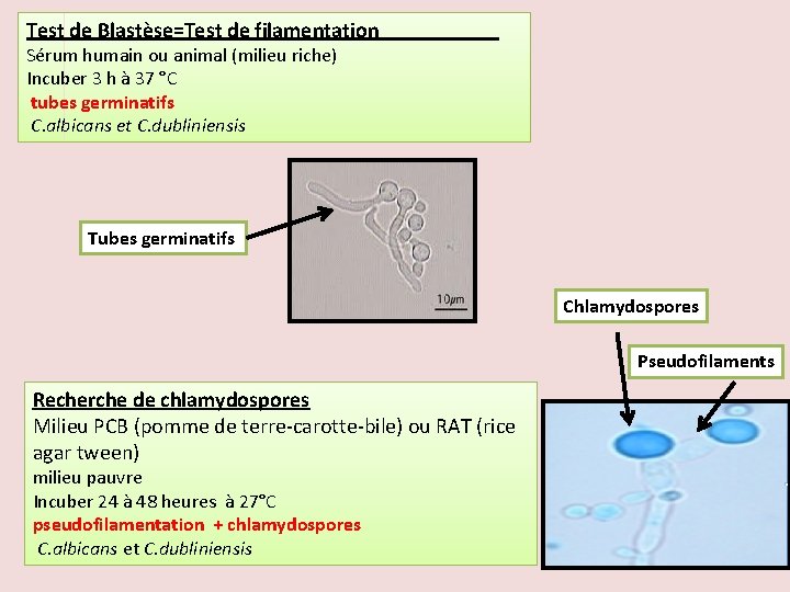 Test de Blastèse=Test de filamentation Sérum humain ou animal (milieu riche) Incuber 3 h