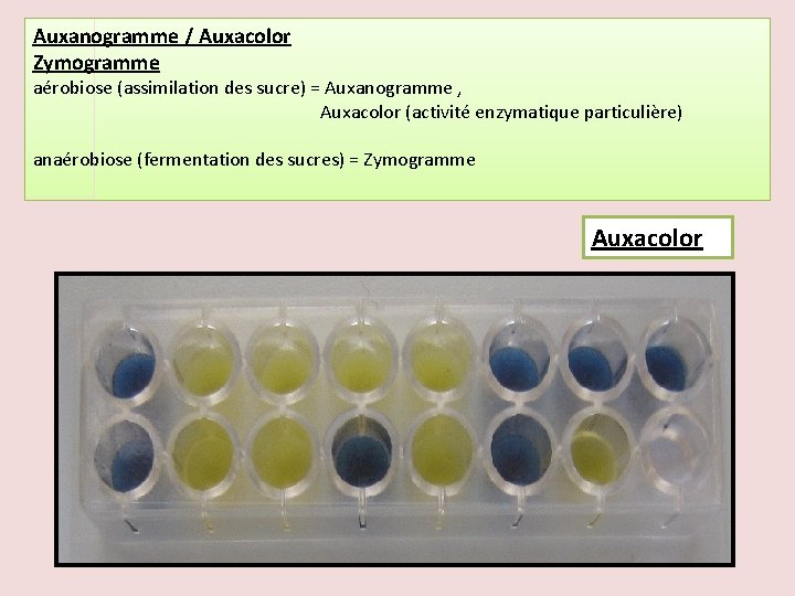 Auxanogramme / Auxacolor Zymogramme aérobiose (assimilation des sucre) = Auxanogramme , Auxacolor (activité enzymatique