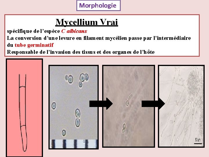 Morphologie Mycellium Vrai spécifique de l’espèce C albicans La conversion d’une levure en filament