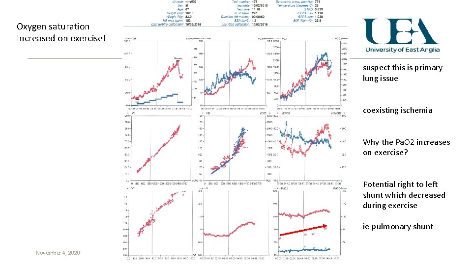 Oxygen saturation Increased on exercise! suspect this is primary lung issue coexisting ischemia Why