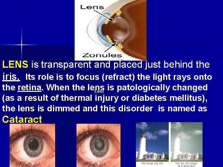 LENS is transparent and placed just behind the iris. Its role is to focus