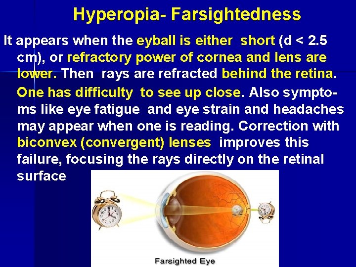  Hyperopia- Farsightedness It appears when the eyball is either short (d < 2.
