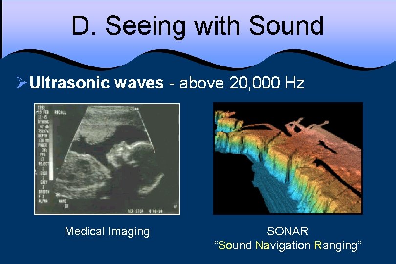 D. Seeing with Sound ØUltrasonic waves - above 20, 000 Hz Medical Imaging SONAR