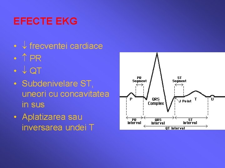 EFECTE EKG frecventei cardiace PR QT Subdenivelare ST, uneori cu concavitatea in sus •