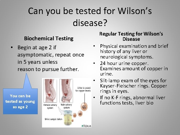 Can you be tested for Wilson’s disease? Biochemical Testing • Begin at age 2