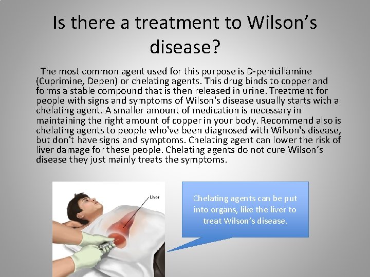 Is there a treatment to Wilson’s disease? The most common agent used for this
