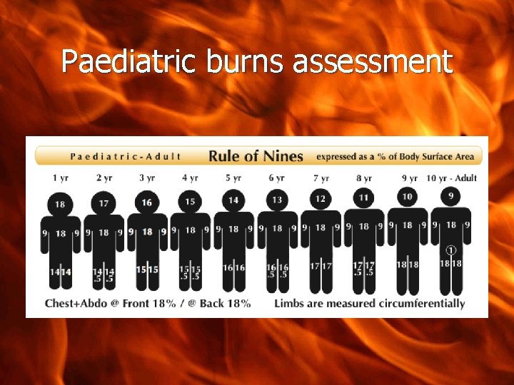 Paediatric burns assessment 