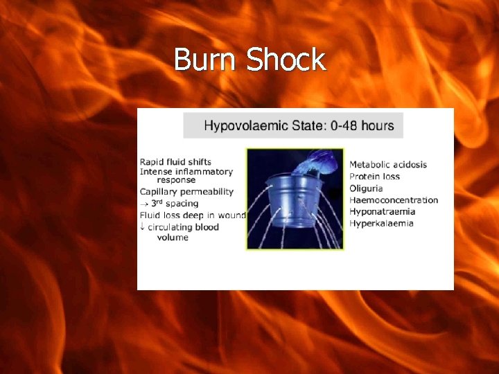 Management of severe burns Who gets admitted to