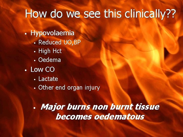 How do we see this clinically? ? • Hypovolaemia • • Reduced UO, BP