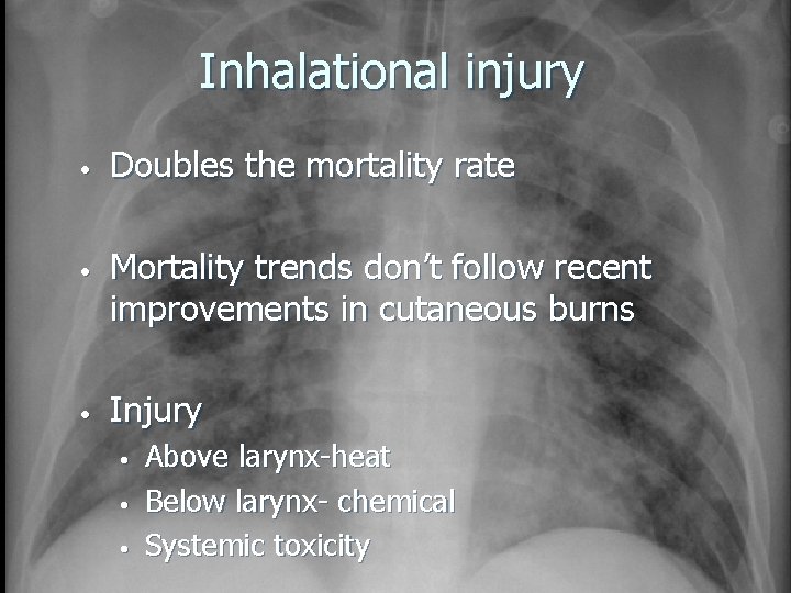 Inhalational injury • • • Doubles the mortality rate Mortality trends don’t follow recent