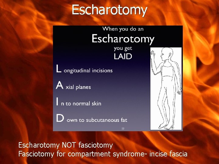 Escharotomy NOT fasciotomy Fasciotomy for compartment syndrome- incise fascia 