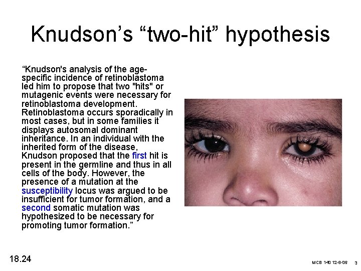 Knudson’s “two-hit” hypothesis “Knudson's analysis of the agespecific incidence of retinoblastoma led him to
