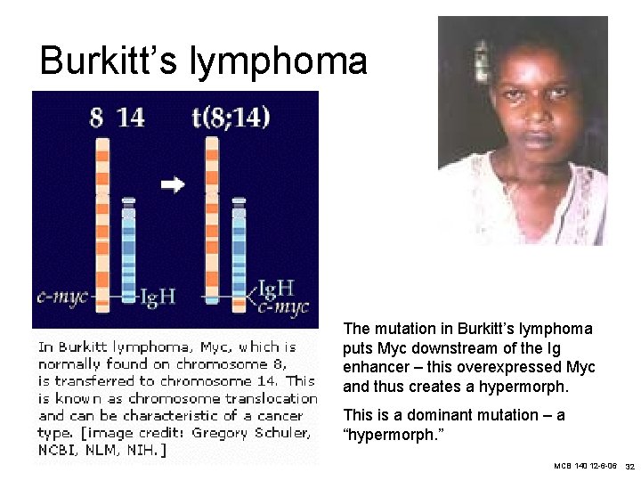 Burkitt’s lymphoma The mutation in Burkitt’s lymphoma puts Myc downstream of the Ig enhancer