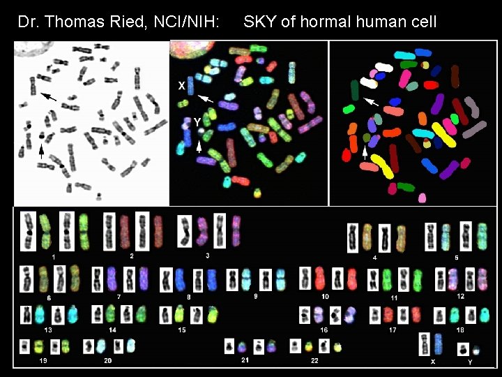 Dr. Thomas Ried, NCI/NIH: SKY of hormal human cell MCB 140 12 -6 -06