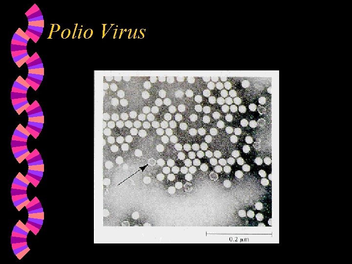 Polio Virus 