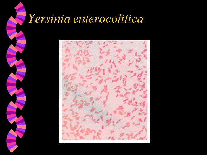 Yersinia enterocolitica 