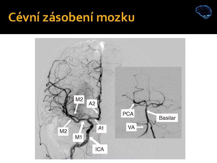 Cévní zásobení mozku 