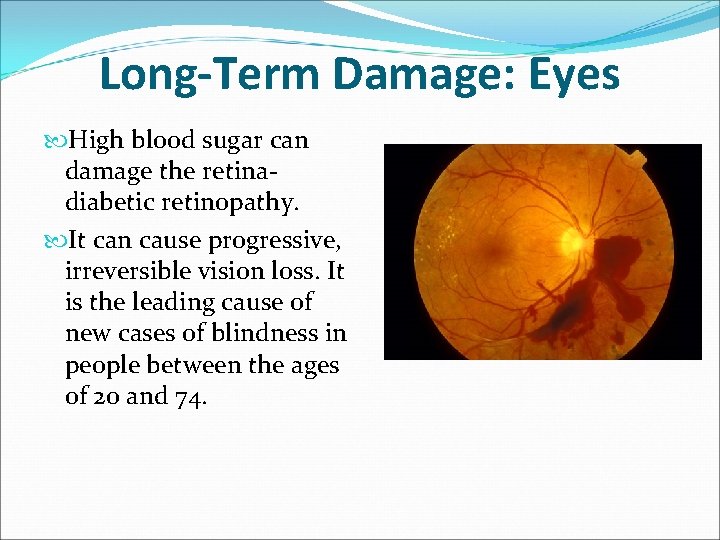 Long-Term Damage: Eyes High blood sugar can damage the retinadiabetic retinopathy. It can cause