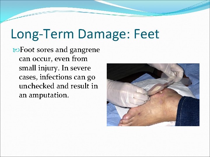 Long-Term Damage: Feet Foot sores and gangrene can occur, even from small injury. In