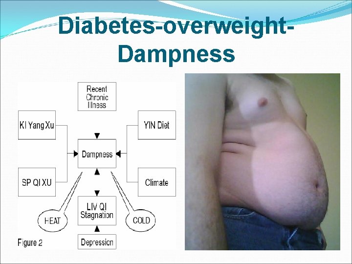 Diabetes-overweight. Dampness 