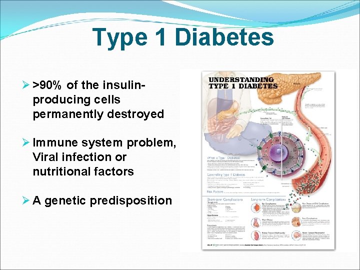 Type 1 Diabetes Ø >90% of the insulinproducing cells permanently destroyed Ø Immune system