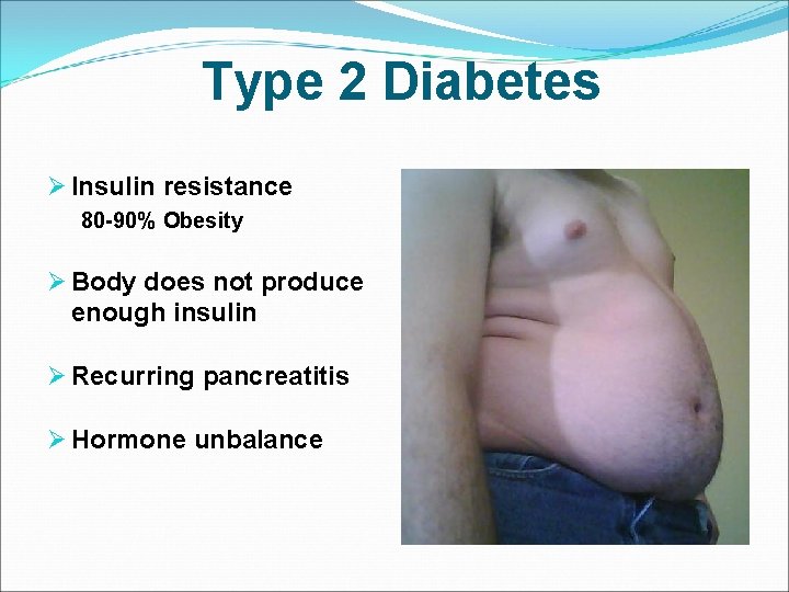 Type 2 Diabetes Ø Insulin resistance 80 -90% Obesity Ø Body does not produce