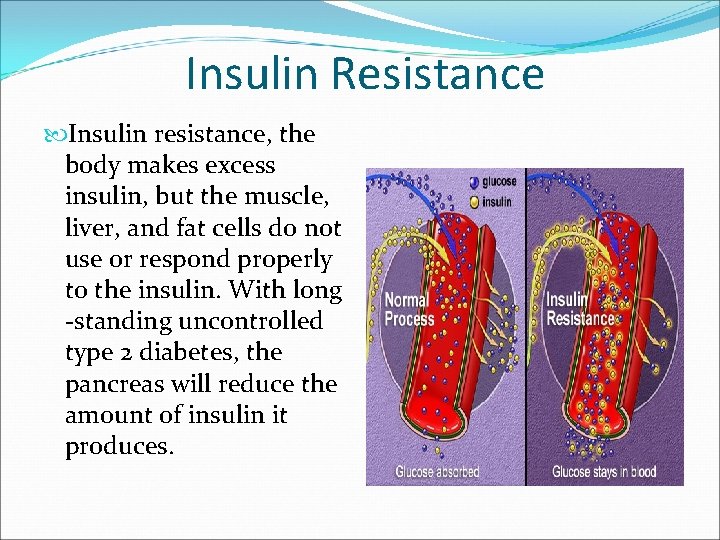 Insulin Resistance Insulin resistance, the body makes excess insulin, but the muscle, liver, and